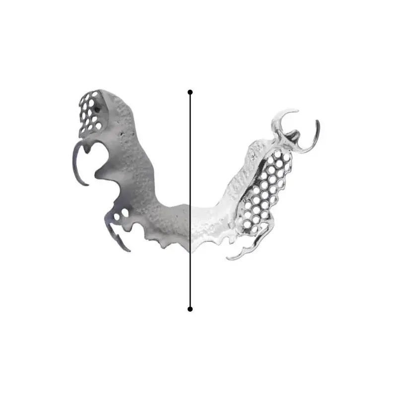 Klammerprothese vorher nachher jpg